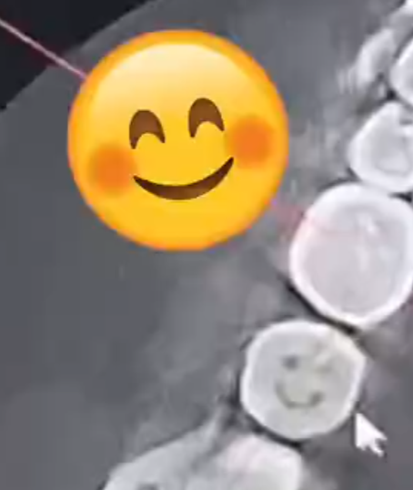 美团月付可以随时取消吗